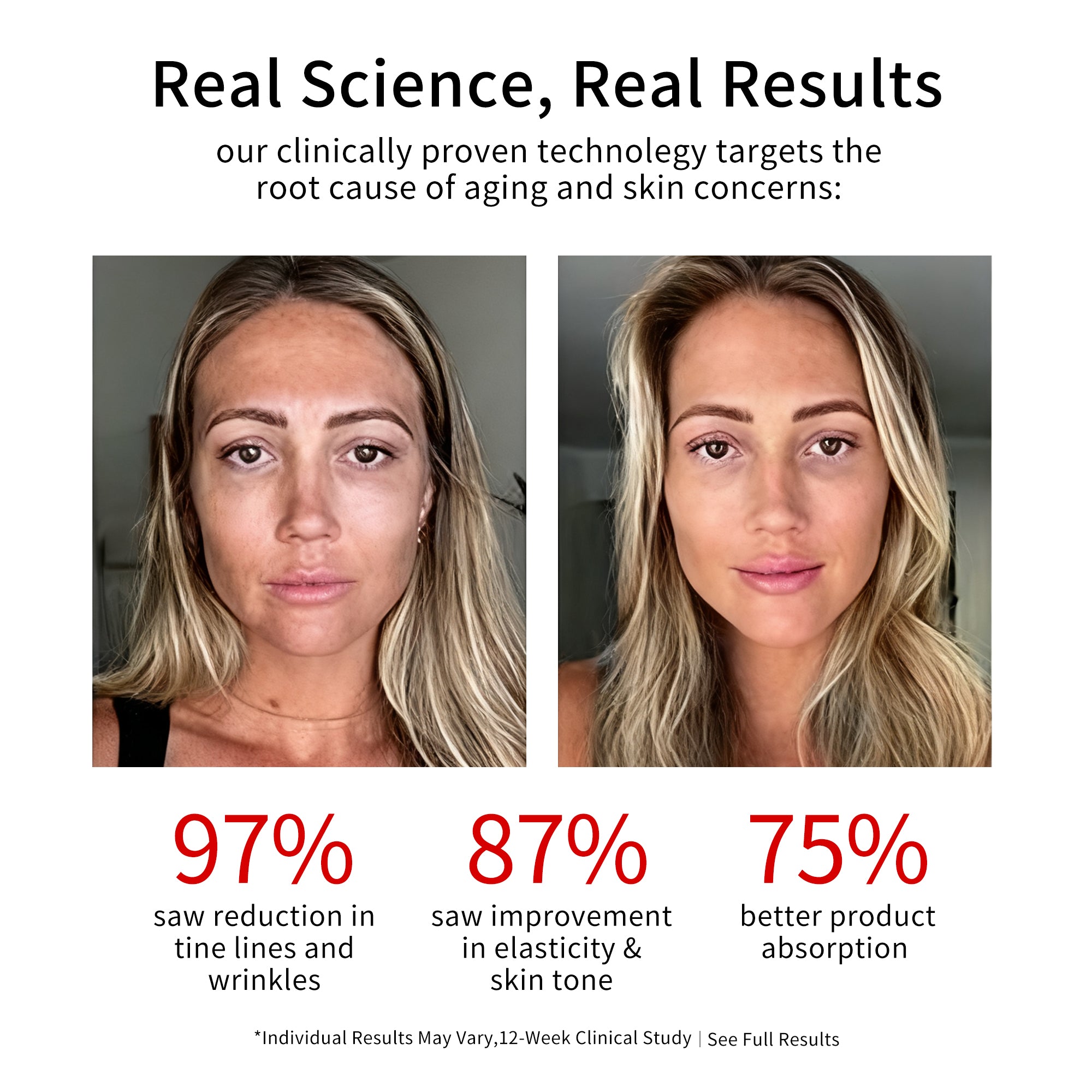 Face and Neck Sculpting Device