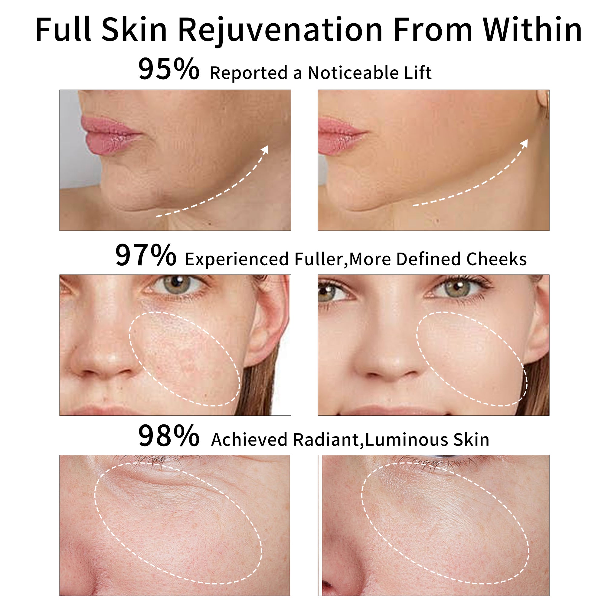 Facial Rejuvenating Device